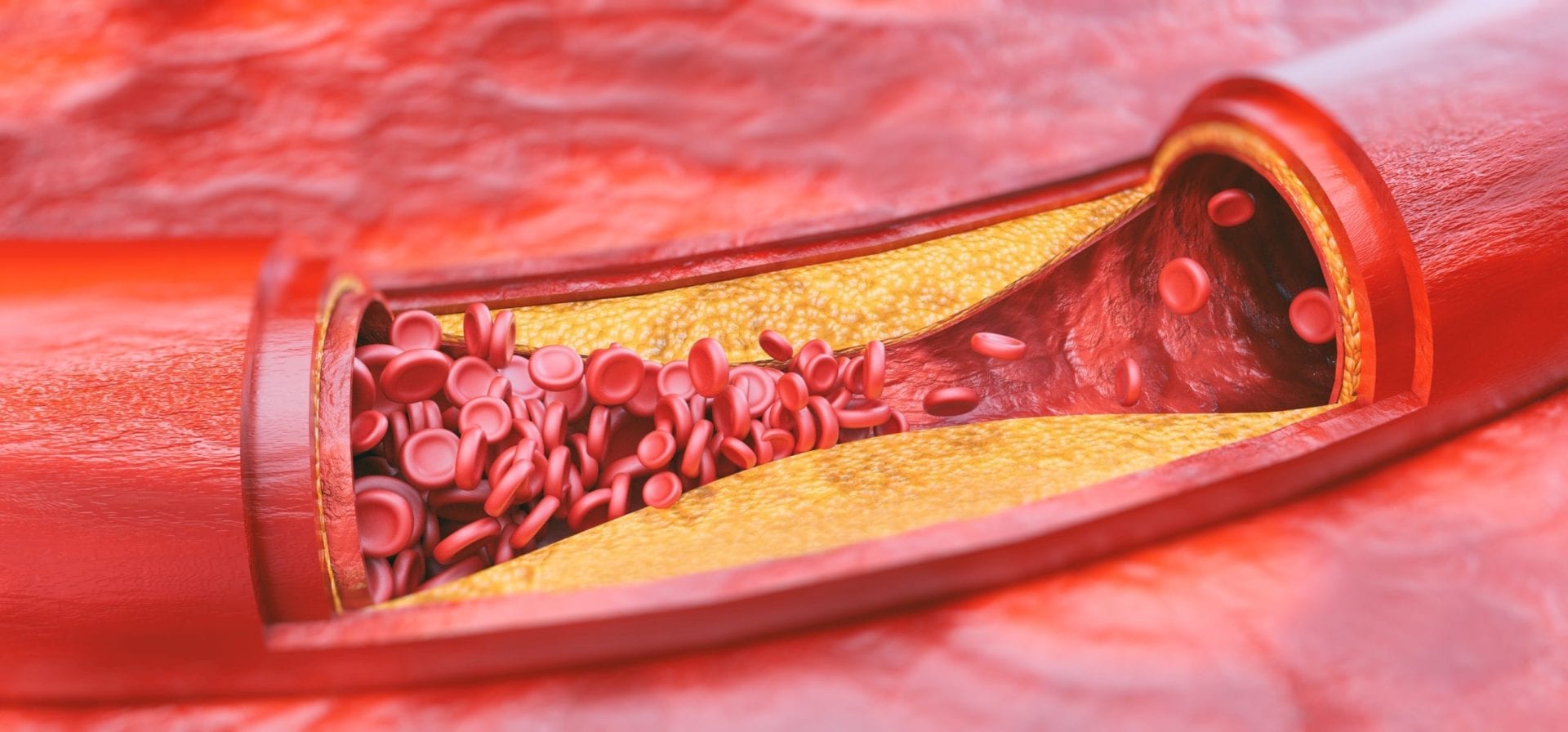 hdl and ldl cholesterol 