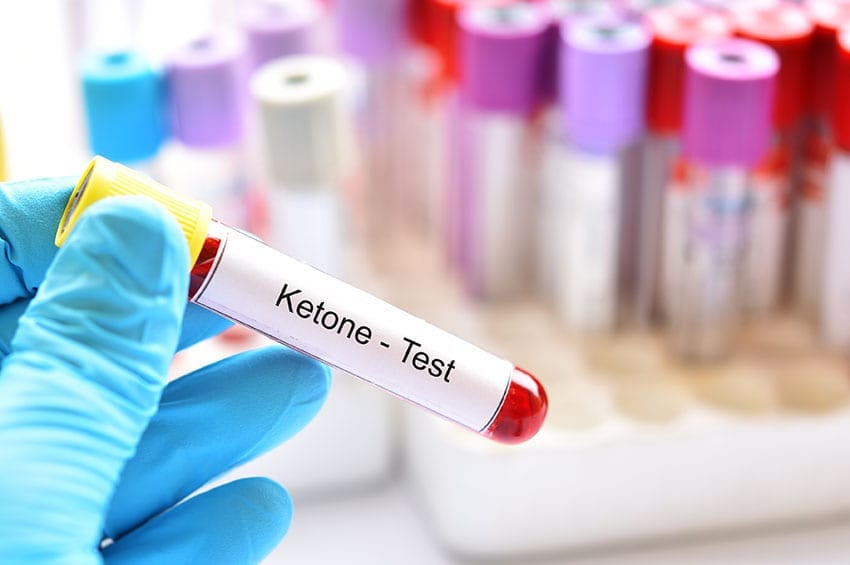 ketoacidosis - ketone test