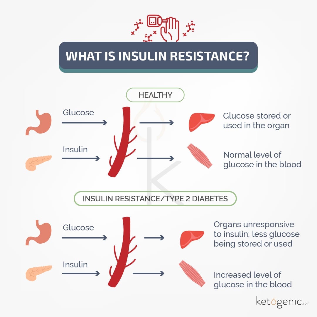 Improving insulin sensitivity