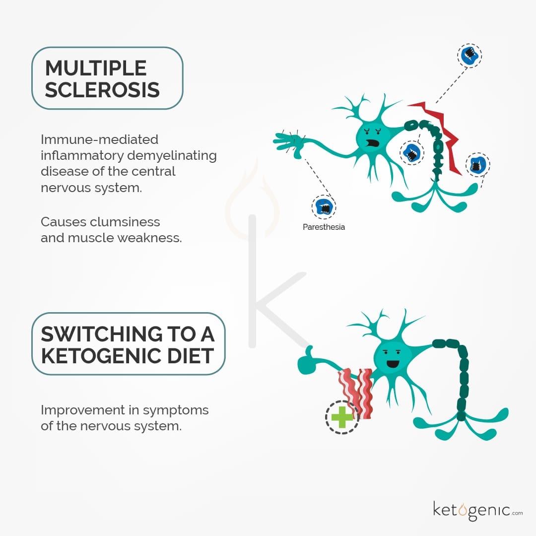 multiple sclerosis and the ketogenic diet