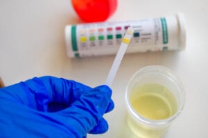Ketones in Urine: What Does It Mean? - Keto Science
