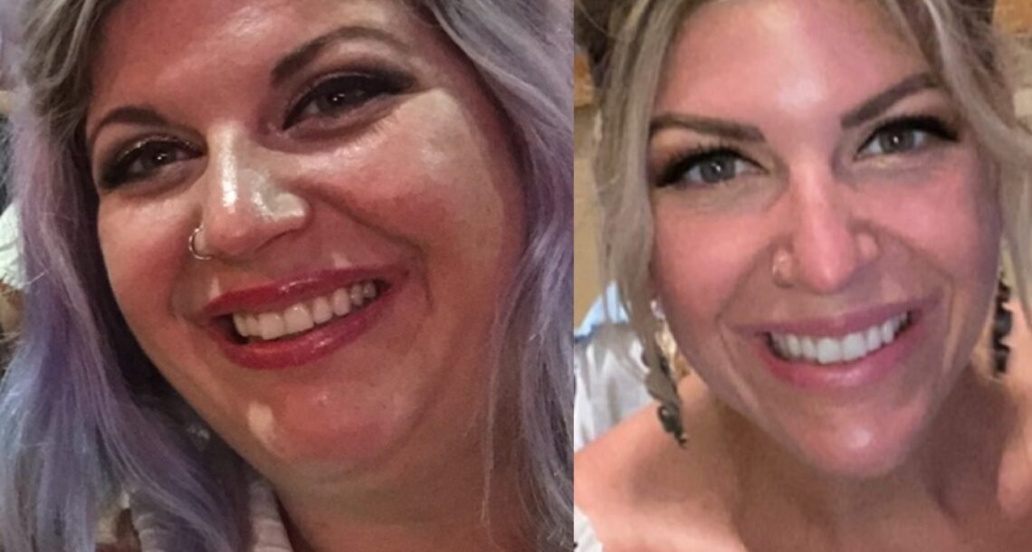 Mary Daniels before and after face gains