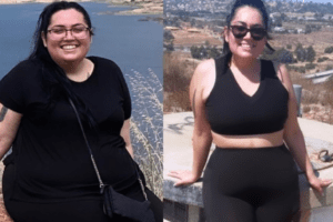 Mireya Munoz before and after photos