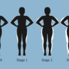 Any stage of lipedema can improve on keto